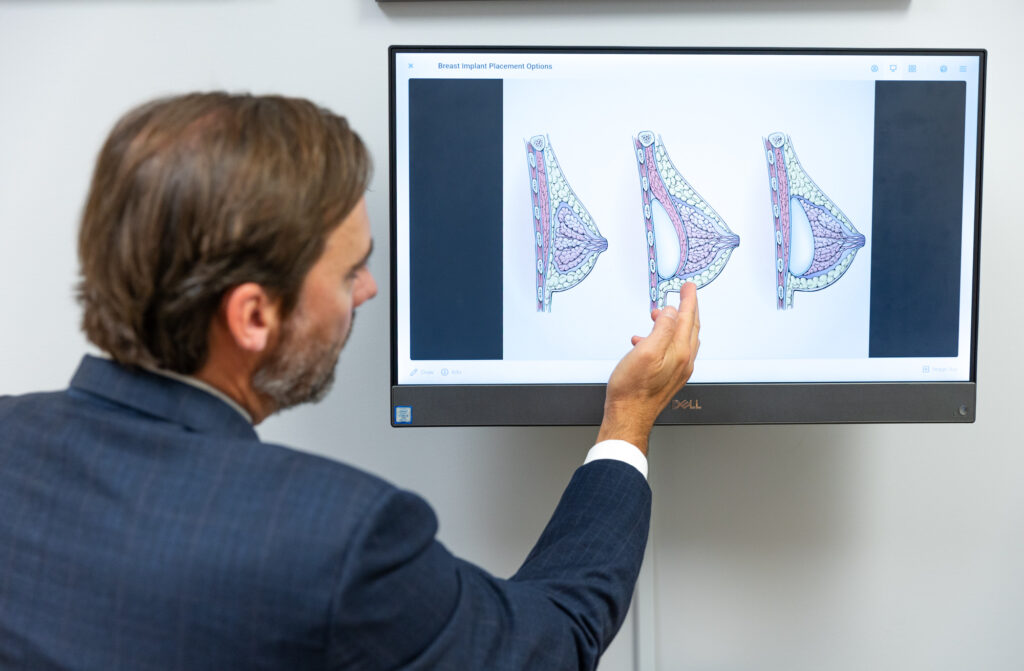 breast augmentation consultation