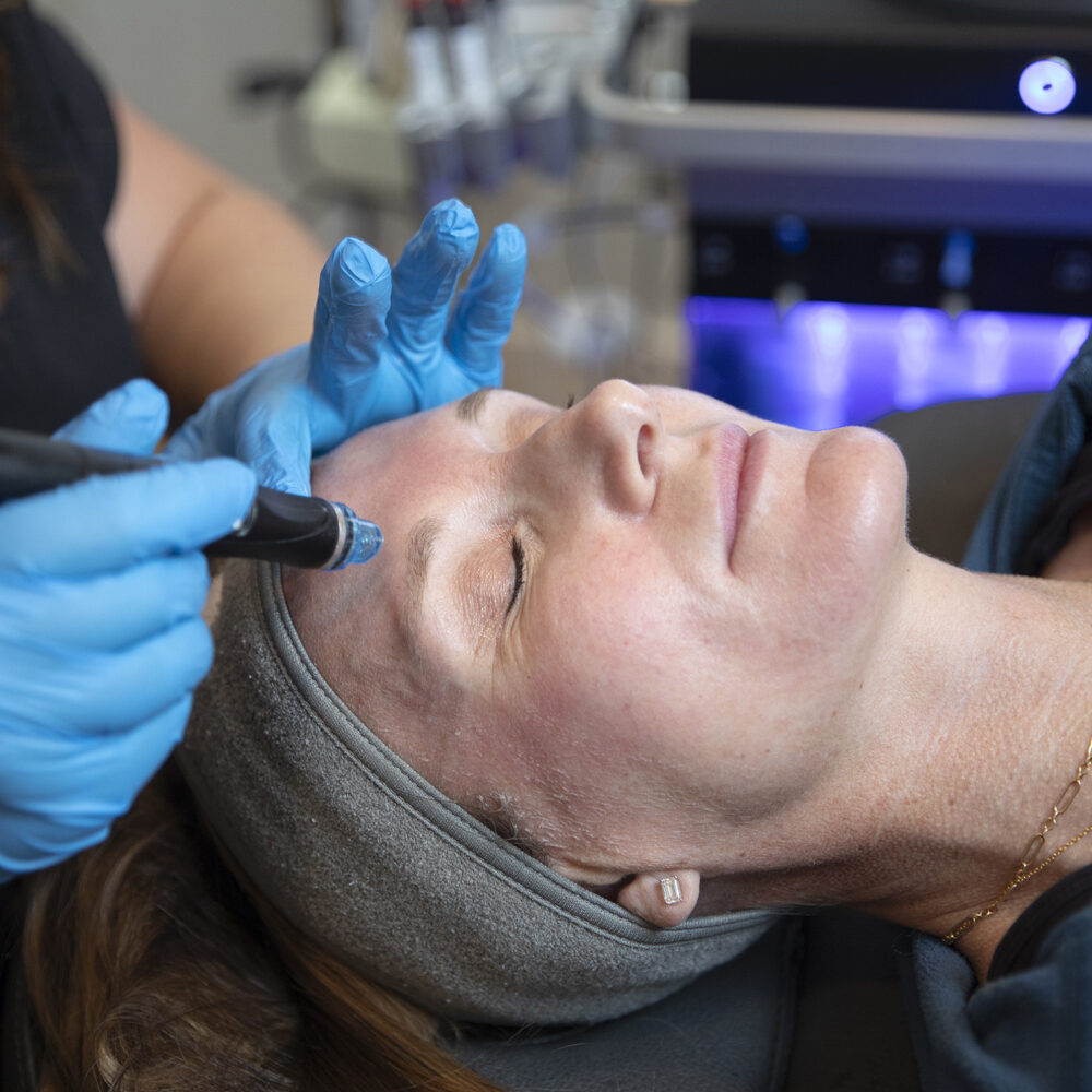 woman receiving Hydrafacial treatment