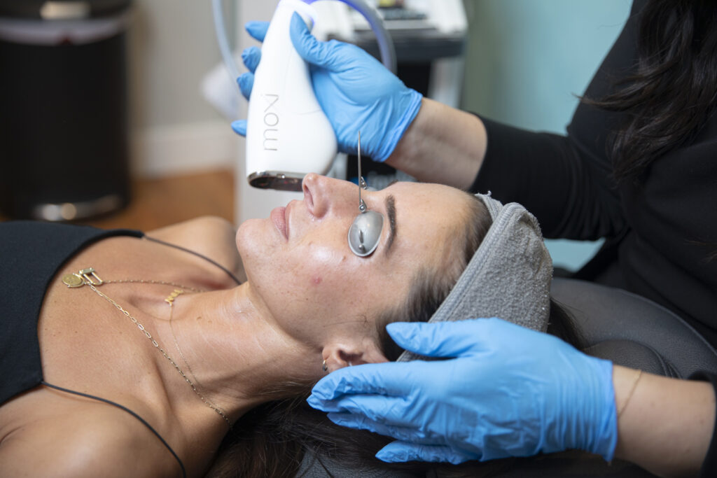 Patient receiving Sciton Moxi treatment on the face