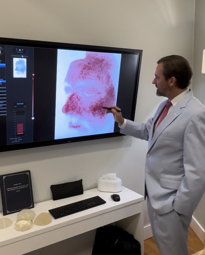 visia skin analysis